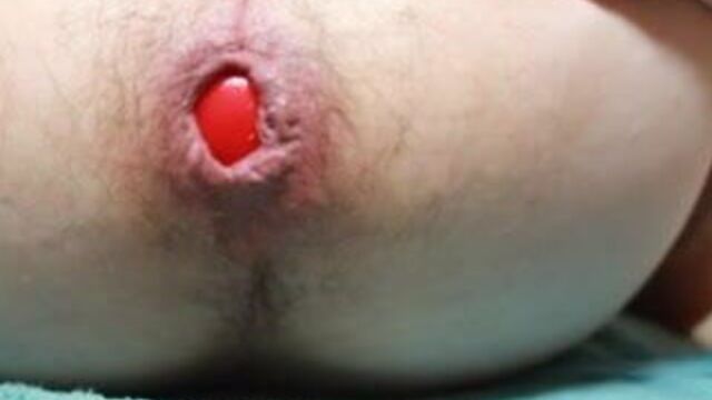 Toy and anti-stress ball in the ass